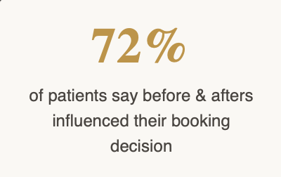 Patients say about before/afetrs